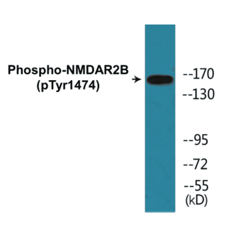 Western Blot - NMDAR2B (phospho Tyr1474) Cell Based ELISA Kit (CBP1185) - Antibodies.com