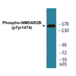 Western Blot - NMDAR2B (phospho Tyr1474) Cell Based ELISA Kit (CBP1185) - Antibodies.com