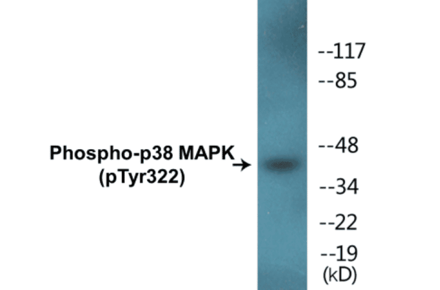 Western Blot - p38 MAPK (phospho Tyr322) Cell Based ELISA Kit (CBP1303) - Antibodies.com