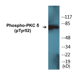 Western Blot - PKC delta (phospho Tyr52) Cell Based ELISA Kit (CBP1306) - Antibodies.com