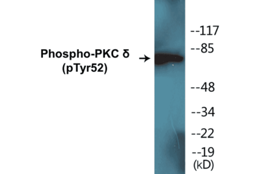 Western Blot - PKC delta (phospho Tyr52) Cell Based ELISA Kit (CBP1306) - Antibodies.com
