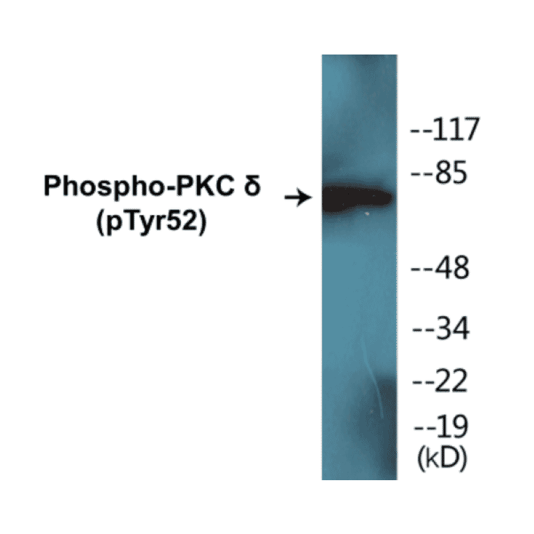 Western Blot - PKC delta (phospho Tyr52) Cell Based ELISA Kit (CBP1306) - Antibodies.com