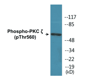Western Blot - PKC zeta (phospho Thr560) Cell Based ELISA Kit (CBP1310) - Antibodies.com