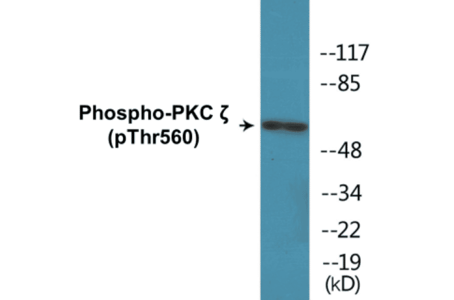 Western Blot - PKC zeta (phospho Thr560) Cell Based ELISA Kit (CBP1310) - Antibodies.com