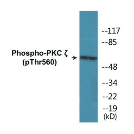 Western Blot - PKC zeta (phospho Thr560) Cell Based ELISA Kit (CBP1310) - Antibodies.com