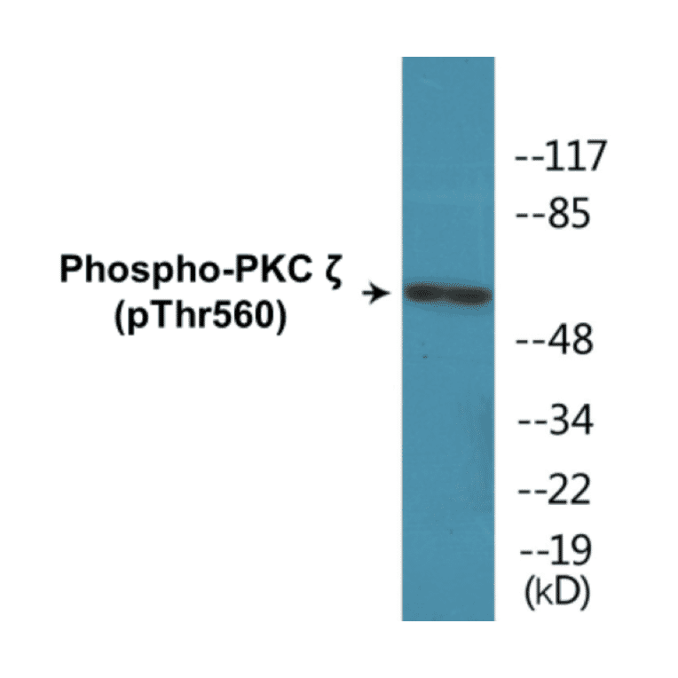 Western Blot - PKC zeta (phospho Thr560) Cell Based ELISA Kit (CBP1310) - Antibodies.com