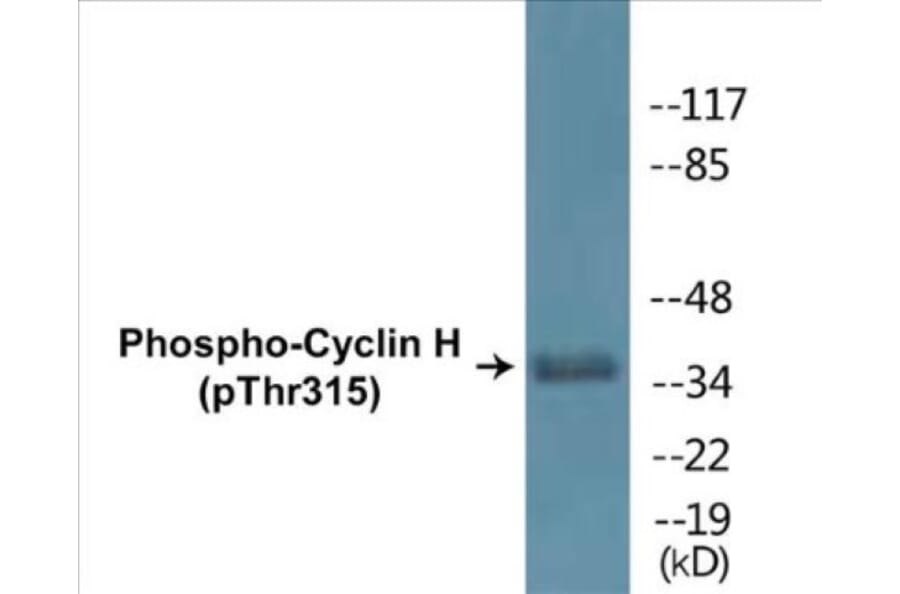 Western Blot - Cyclin H (phospho Thr315) Cell Based ELISA Kit (CBP1353) - Antibodies.com