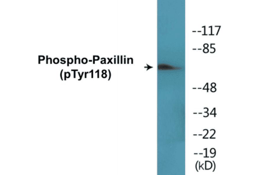 Western Blot - Paxillin (phospho Tyr118) Cell Based ELISA Kit (CBP1654) - Antibodies.com