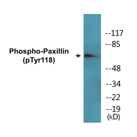 Western Blot - Paxillin (phospho Tyr118) Cell Based ELISA Kit (CBP1654) - Antibodies.com