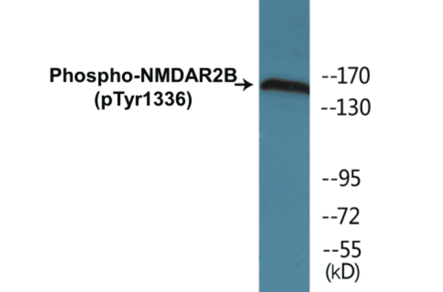 Western Blot - NMDAR2B (phospho Tyr1336) Cell Based ELISA Kit (CBP1800) - Antibodies.com