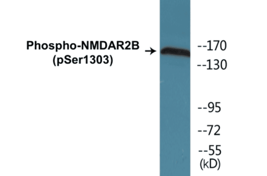 Western Blot - NMDAR2B (phospho Ser1303) Cell Based ELISA Kit (CBP1859) - Antibodies.com