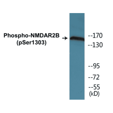 Western Blot - NMDAR2B (phospho Ser1303) Cell Based ELISA Kit (CBP1859) - Antibodies.com