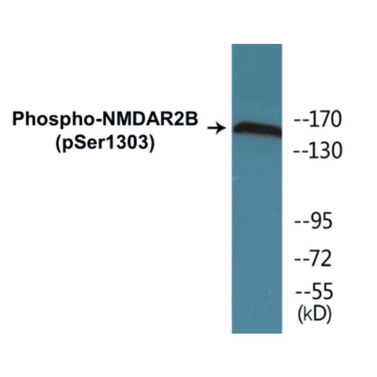 Western Blot - NMDAR2B (phospho Ser1303) Cell Based ELISA Kit (CBP1859) - Antibodies.com