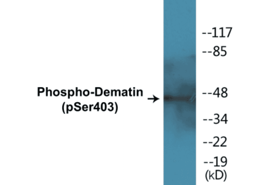 Western Blot - Dematin (phospho Ser403) Cell Based ELISA Kit (CBP1362) - Antibodies.com