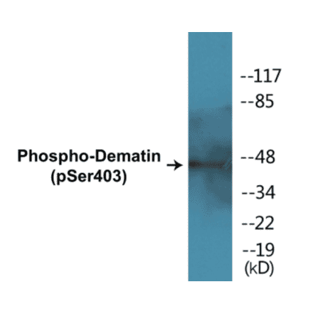 Western Blot - Dematin (phospho Ser403) Cell Based ELISA Kit (CBP1362) - Antibodies.com