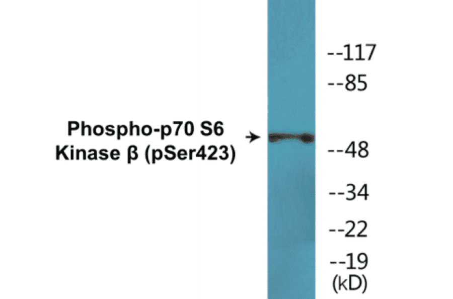 Western Blot - p70S6 Kinase beta (phospho Ser423) Cell Based ELISA Kit (CBP1760) - Antibodies.com