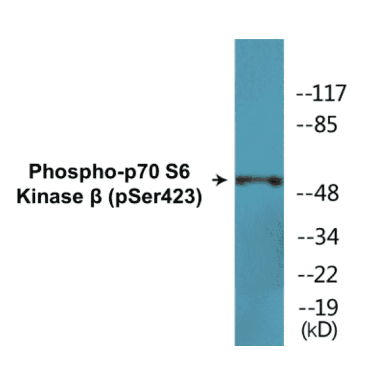 Western Blot - p70S6 Kinase beta (phospho Ser423) Cell Based ELISA Kit (CBP1760) - Antibodies.com