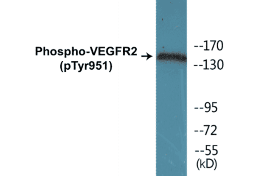 Western Blot - VEGFR2 (phospho Tyr951) Cell Based ELISA Kit (CBP1707) - Antibodies.com