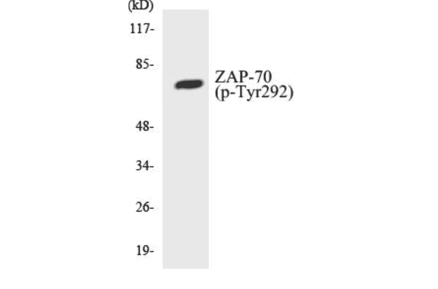 Western Blot - ZAP-70 (phospho Tyr292) Cell Based ELISA Kit (CBP1234) - Antibodies.com