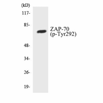 Western Blot - ZAP-70 (phospho Tyr292) Cell Based ELISA Kit (CBP1234) - Antibodies.com