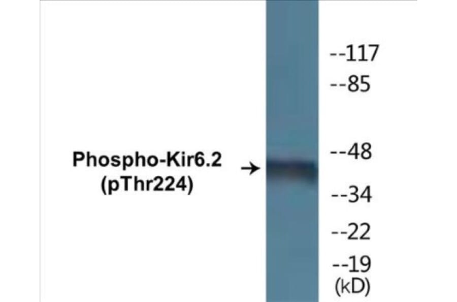 Western Blot - Kir6.2 (phospho Thr224) Cell Based ELISA Kit (CBP1432) - Antibodies.com
