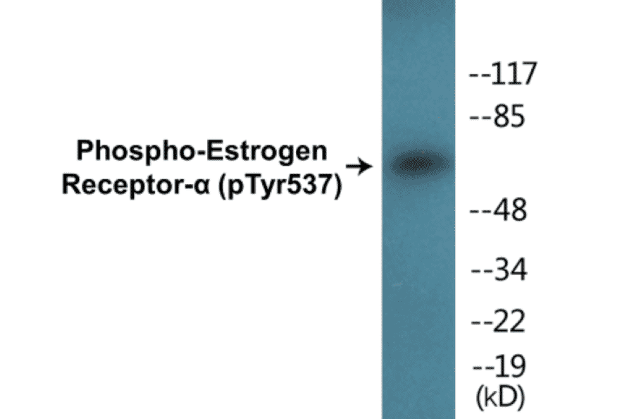 Western Blot - Estrogen Receptor alpha (phospho Tyr537) Cell Based ELISA Kit (CBP1152) - Antibodies.com