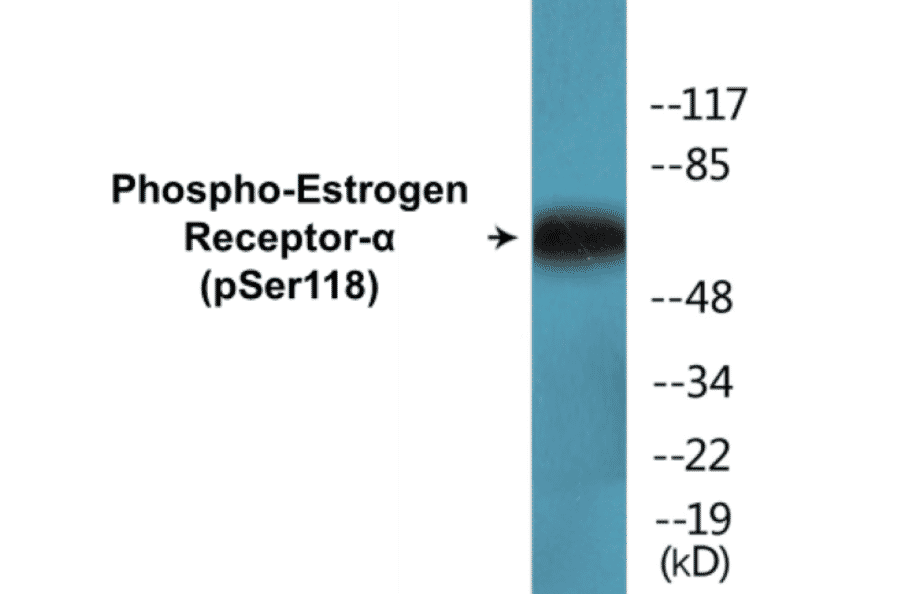 Western Blot - Estrogen Receptor alpha (phospho Ser118) Cell Based ELISA Kit (CBP1548) - Antibodies.com