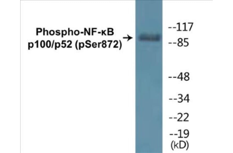 Western Blot - NF-kB p100 / p52 (phospho Ser872) Cell Based ELISA Kit (CBP1435) - Antibodies.com