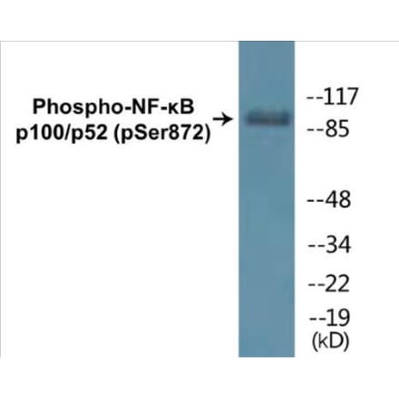 Western Blot - NF-kB p100 / p52 (phospho Ser872) Cell Based ELISA Kit (CBP1435) - Antibodies.com