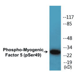 Western Blot - Myogenic Factor 5 (phospho Ser49) Cell Based ELISA Kit (CBP1473) - Antibodies.com