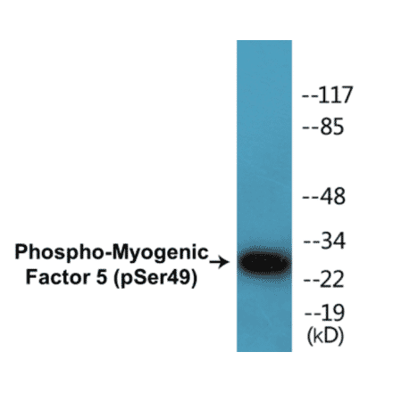Western Blot - Myogenic Factor 5 (phospho Ser49) Cell Based ELISA Kit (CBP1473) - Antibodies.com