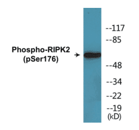 Western Blot - RIPK2 (phospho Ser176) Cell Based ELISA Kit (CBP1771) - Antibodies.com