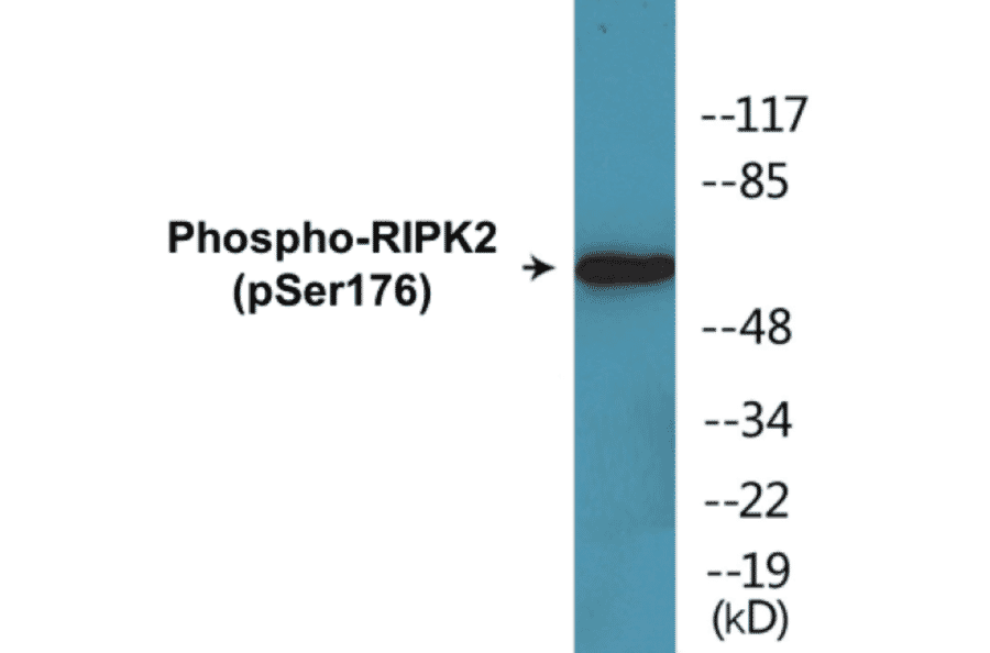 Western Blot - RIPK2 (phospho Ser176) Cell Based ELISA Kit (CBP1771) - Antibodies.com