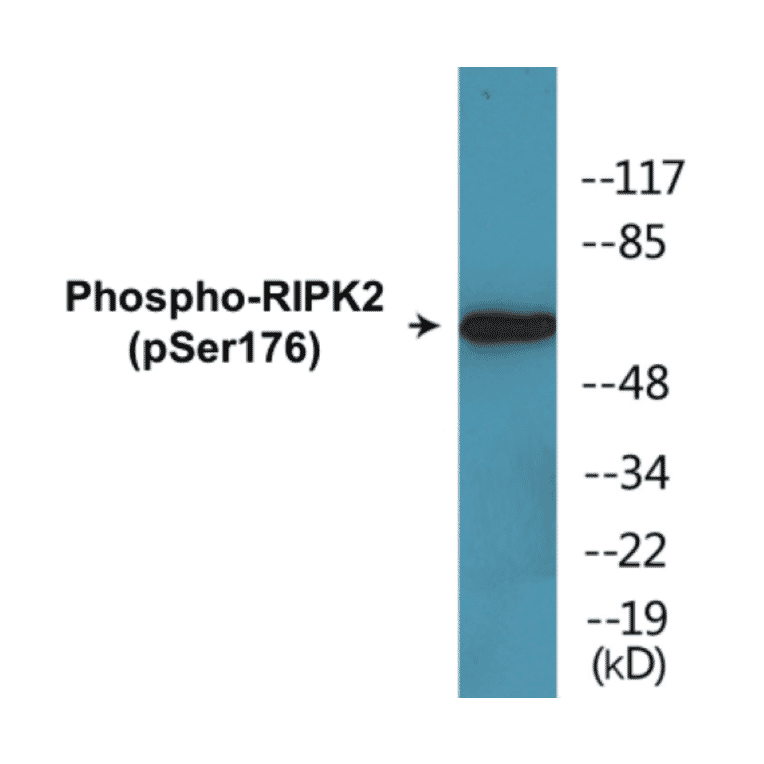 Western Blot - RIPK2 (phospho Ser176) Cell Based ELISA Kit (CBP1771) - Antibodies.com