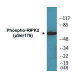 Western Blot - RIPK2 (phospho Ser176) Cell Based ELISA Kit (CBP1771) - Antibodies.com