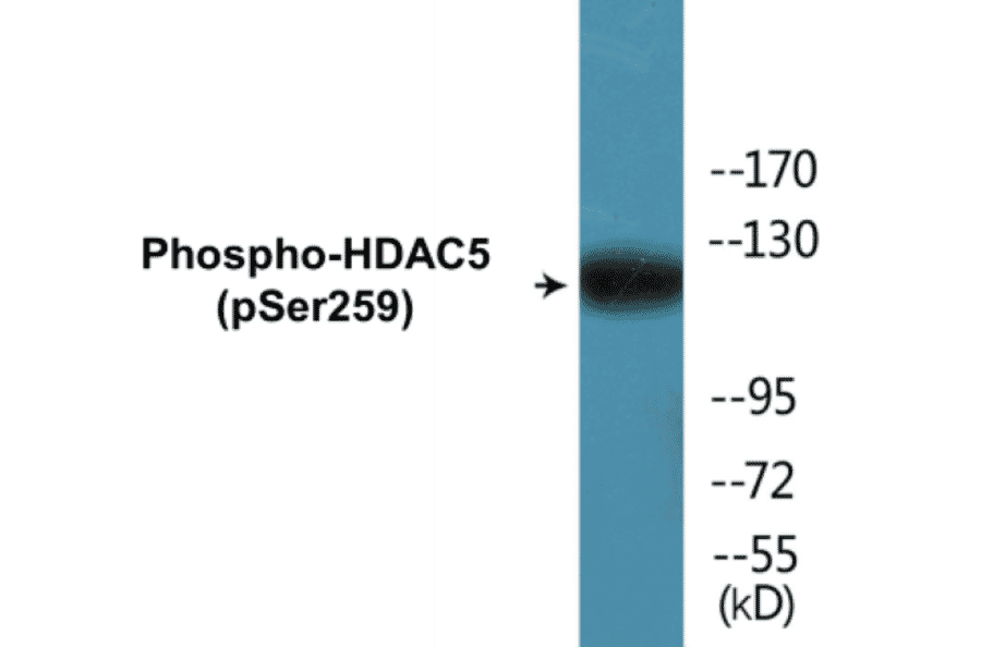 Western Blot - HDAC5 (phospho Ser259) Cell Based ELISA Kit (CBP1123) - Antibodies.com