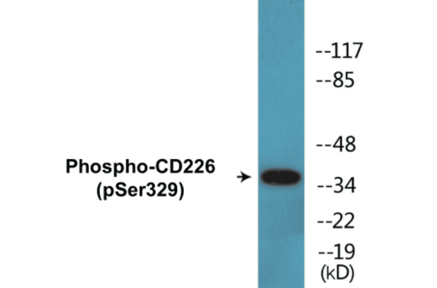 Western Blot - CD226 (phospho Ser329) Cell Based ELISA Kit (CBP1337) - Antibodies.com