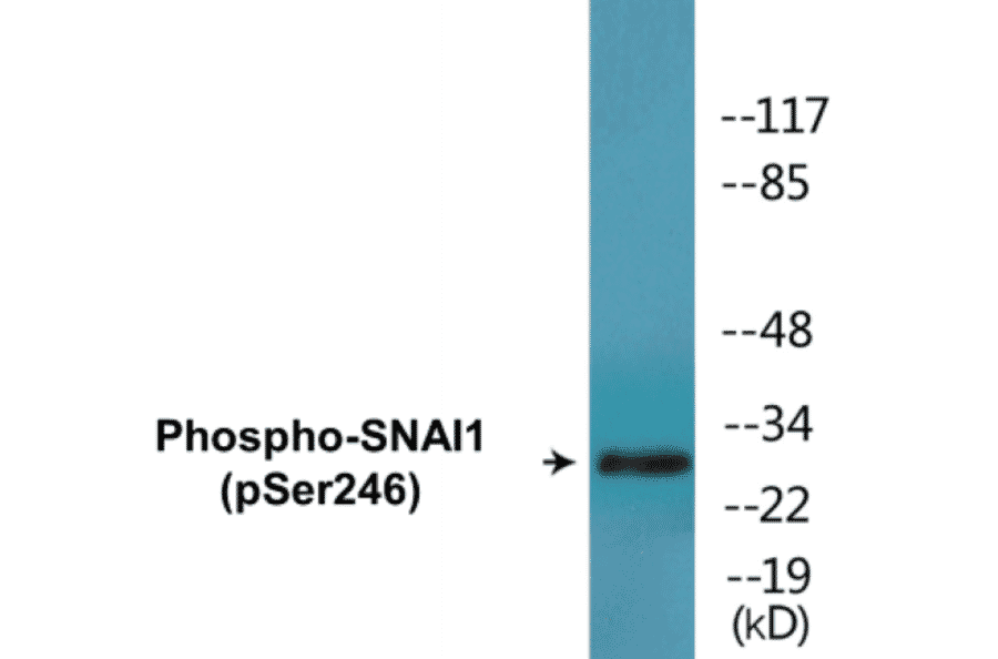 Western Blot - SNAI1 (phospho Ser246) Cell Based ELISA Kit (CBP1479) - Antibodies.com