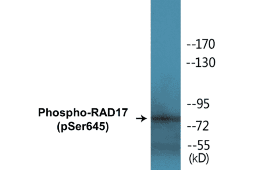 Western Blot - RAD17 (phospho Ser645) Cell Based ELISA Kit (CBP1078) - Antibodies.com