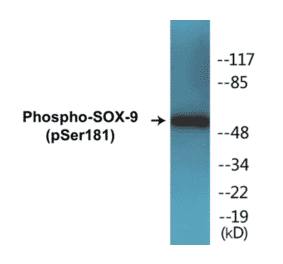 Western Blot - SOX-9 (phospho Ser181) Cell Based ELISA Kit (CBP1216) - Antibodies.com