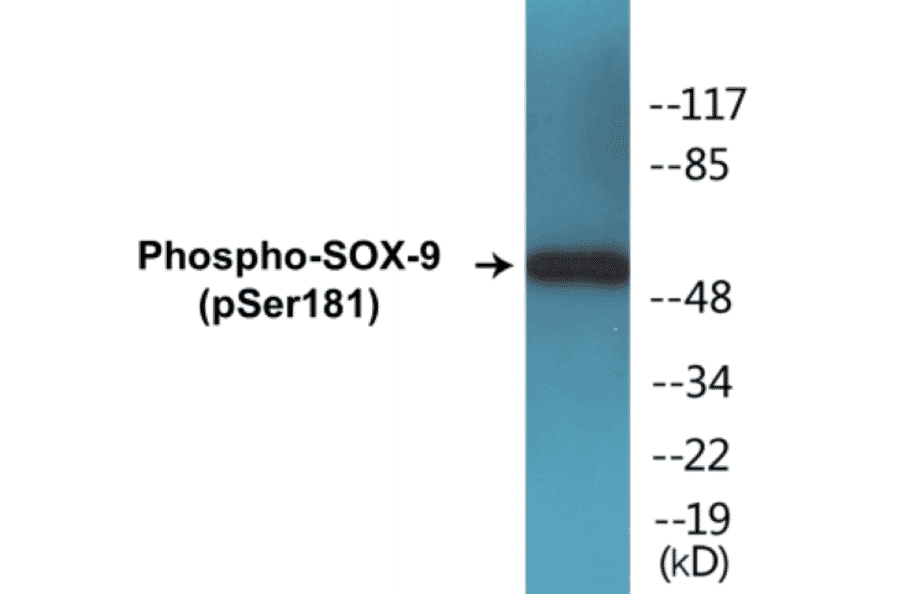 Western Blot - SOX-9 (phospho Ser181) Cell Based ELISA Kit (CBP1216) - Antibodies.com