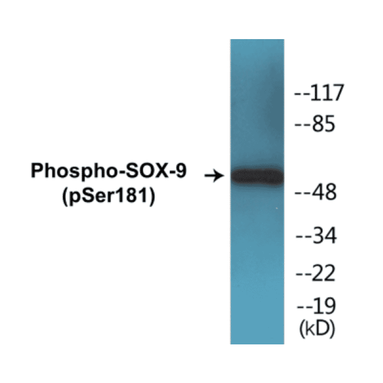 Western Blot - SOX-9 (phospho Ser181) Cell Based ELISA Kit (CBP1216) - Antibodies.com