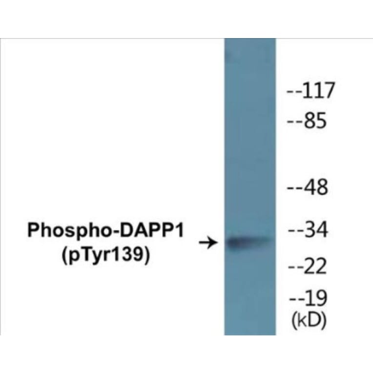 Western Blot - DAPP1 (phospho Tyr139) Cell Based ELISA Kit (CBP1361) - Antibodies.com