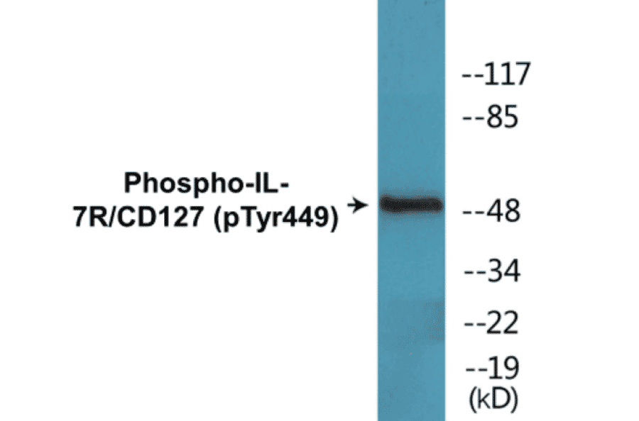 Western Blot - IL-7R (phospho Tyr449) Cell Based ELISA Kit (CBP1421) - Antibodies.com