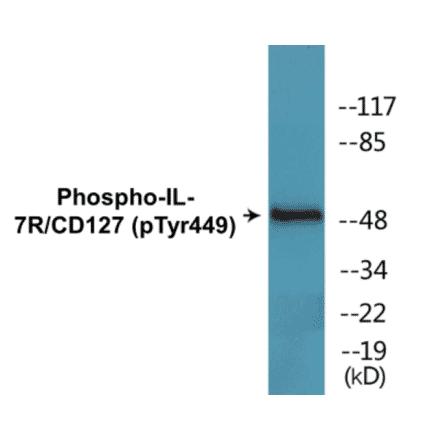 Western Blot - IL-7R (phospho Tyr449) Cell Based ELISA Kit (CBP1421) - Antibodies.com