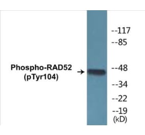 Western Blot - RAD52 (phospho Tyr104) Cell Based ELISA Kit (CBP1438) - Antibodies.com