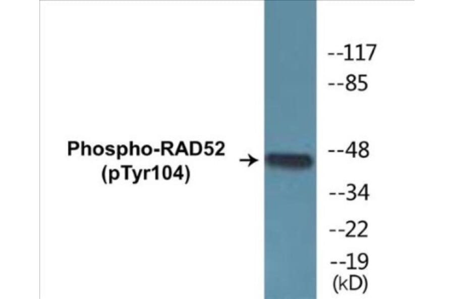 Western Blot - RAD52 (phospho Tyr104) Cell Based ELISA Kit (CBP1438) - Antibodies.com