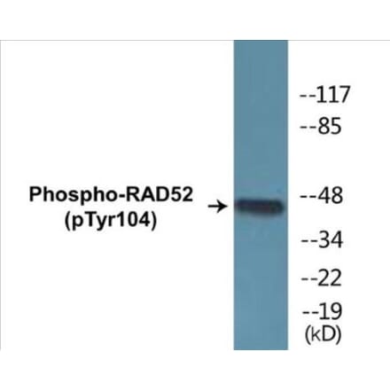 Western Blot - RAD52 (phospho Tyr104) Cell Based ELISA Kit (CBP1438) - Antibodies.com