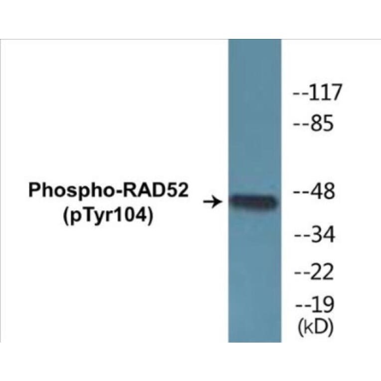 Western Blot - RAD52 (phospho Tyr104) Cell Based ELISA Kit (CBP1438) - Antibodies.com
