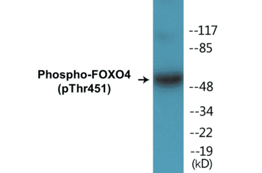 Western Blot - FOXO4 (phospho Thr451) Cell Based ELISA Kit (CBP1449) - Antibodies.com